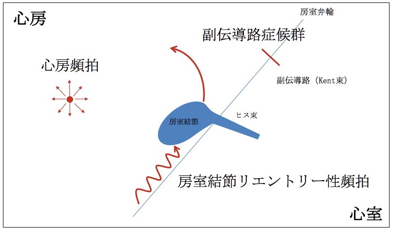 室 上 発作 性 拍 性 頻