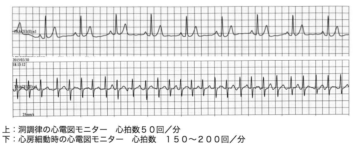 脈拍 数 50