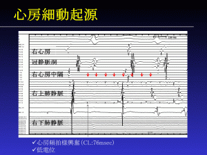 20131216_心房細動起源