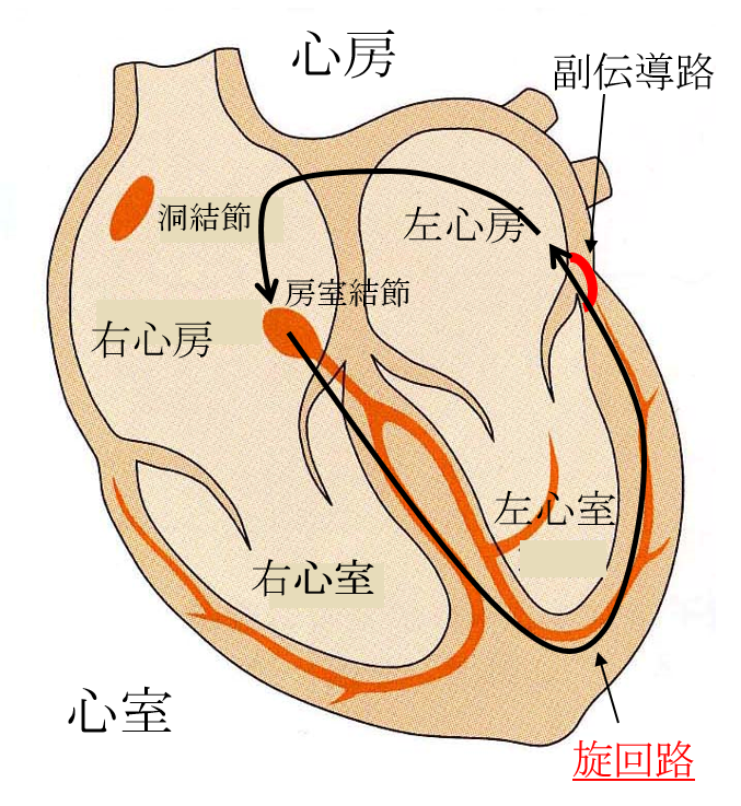 副伝導路症候群の発症メカニズム 心室から心房への電気的興奮の旋回路