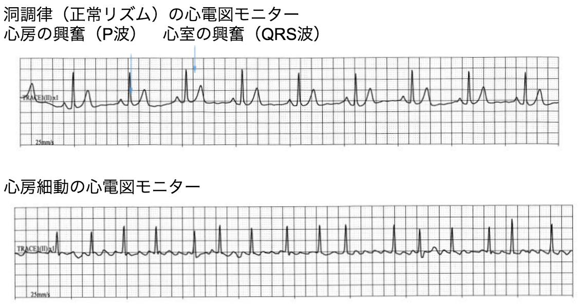 医師に連絡する時期