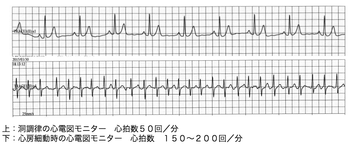 心電図モニター資料画像