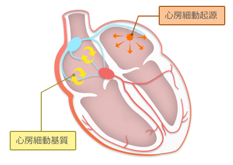 心房細動起源と心房細動基質の解説図